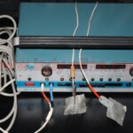 TBC Reizstrom-Elektrostimulanz-1 TBC Reizstrom-Elektrostimulanz-1